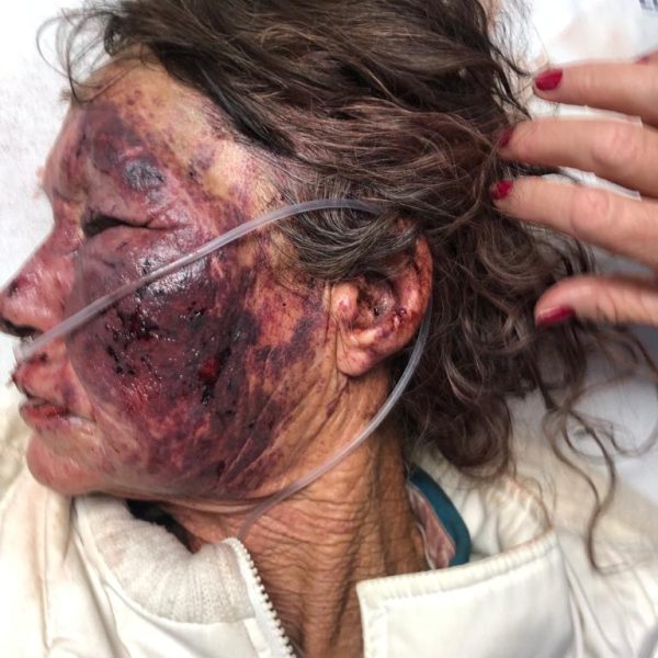 WHITE ELDERLY FARM WOMAN ATTACKED AND RAPED