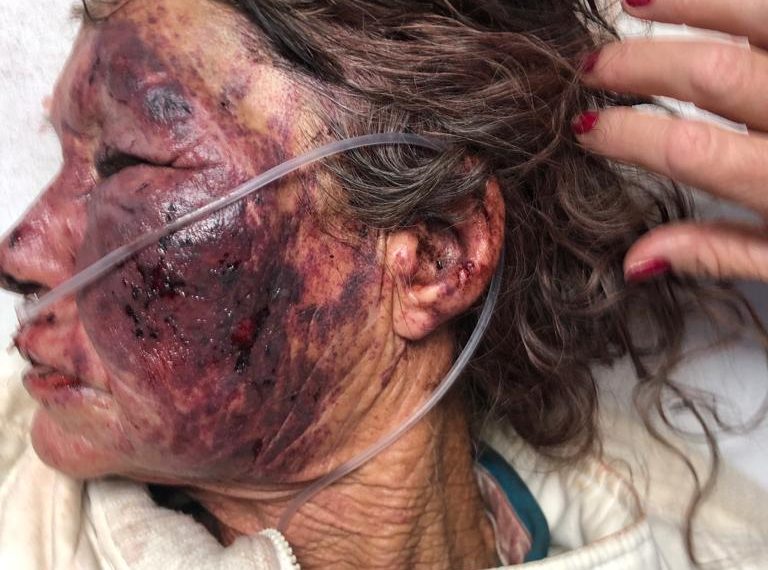WHITE ELDERLY FARM WOMAN ATTACKED AND RAPED